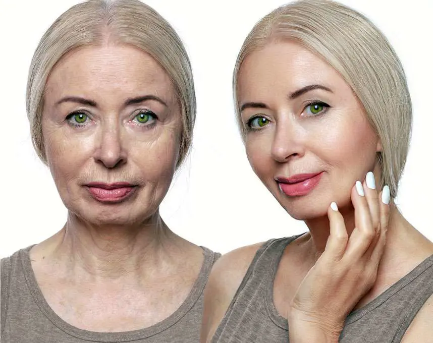 خدمات ضدپیری و جوانسازی