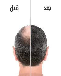 درمان ریزش مو در شرق تهران
درمان تخصصی ریزش مو در شرق تهران | دکتر مهشید طالبی