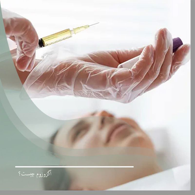 اگزوزوم چیست؟ جوانسازی و ترمیم پوست با دکتر مهشید طالبی
