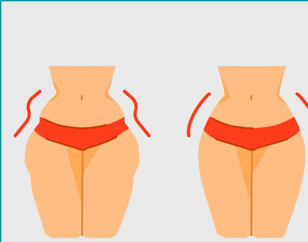 تزریق فیلر هیپ دیپ
